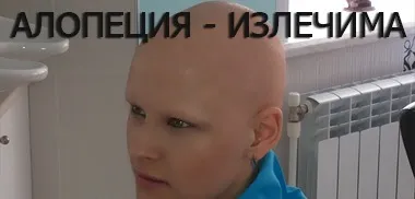 Лікування облисіння, лікування алопеції - центр лікування волосся, алопеція ареата, облисіння (лікування облисіння) Лікування облисіння, лікування алопеції - центр лікування волосся, алопеція ареата, облисіння