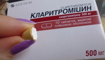 Лікування гаймориту у дорослих народними засобами в домашніх умовах (дорослих) Лікування гаймориту у дорослих народними засобами в домашніх умовах