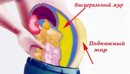 4 Причини виникнення великого живота - мотивація і психологія (органах черевної порожнини) 4 Причини виникнення великого живота - мотивація і психологія