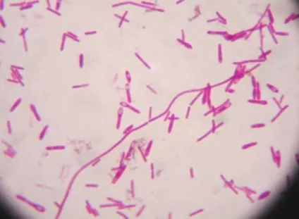 4 Кг бактерії clostridium botulinum досить, щоб убити все людство - фактрум (clostridium botulinum) 4 Кг бактерії clostridium botulinum досить, щоб убити все людство - фактрум