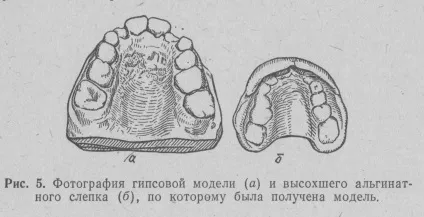 Альгінатние матеріали 2 частина