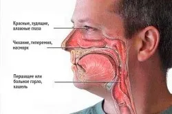 Алергія на мові причини, симптоми і лікування (про алергію) Алергія на мові причини, симптоми і лікування