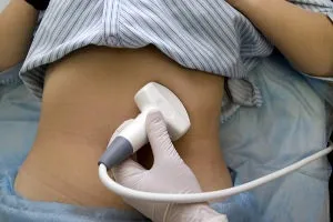 Атеросклероз черевного відділу аорти симптоми, лікування, діагностика, народні засоби (атеросклероз черевного відділу) Атеросклероз черевного відділу аорти симптоми, лікування, діагностика, народні засоби