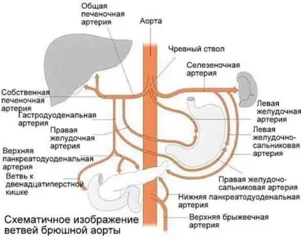 Атеросклероз черевної аорти причини, симптоми, діагностика, лікування, наслідки