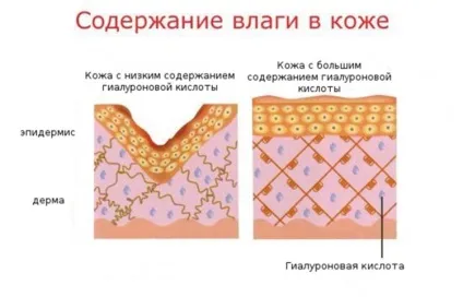 Біоревіталізація особи - показання та протипоказання (особи) Біоревіталізація особи - показання та протипоказання