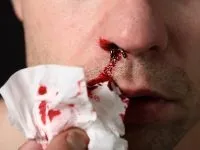 Чим лікувати, якщо дере в носоглотці (лікувати) Чим лікувати, якщо дере в носоглотці