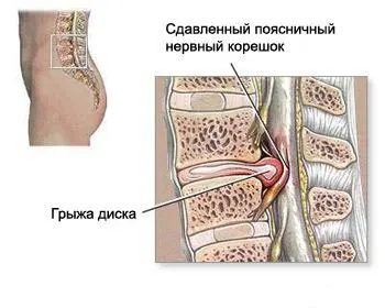 Що показує кт хребта