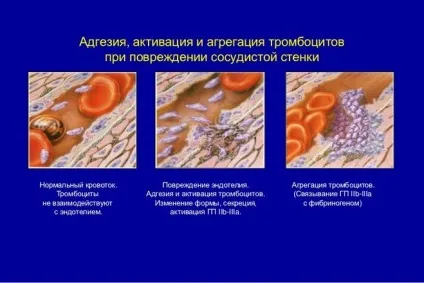 Що значить адгезія