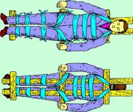 Що таке компресійний перелом хребта симптоми, лікування і наслідки (компресійний) Що таке компресійний перелом хребта симптоми, лікування і наслідки