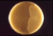 Clostridium perfringens - це