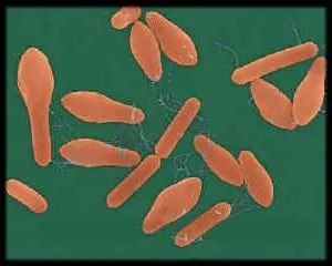 Clostridium botulinum