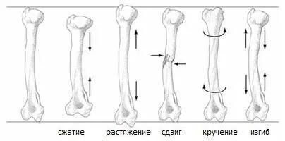 Деформація зрушення, розтягування, стиснення, кручення, вигин (стиснення) Деформація зрушення, розтягування, стиснення, кручення, вигин