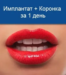 Дисконтна програма - стоматологічна клініка устадент