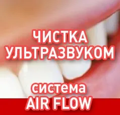 Дисконтна програма - стоматологічна клініка устадент