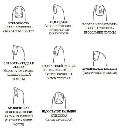Діагностика по нігтях в хіромантії за знаками зодіаку - астрологія для всіх (знакам) Діагностика по нігтях в хіромантії за знаками зодіаку - астрологія для всіх