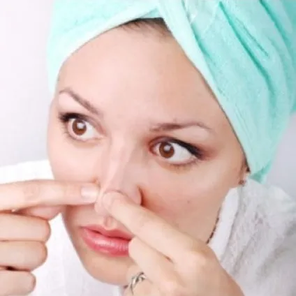 Акнебай - не попадіться на вудку, як позбутися від прищів, засіб від прищів (прищів) Акнебай - не попадіться на вудку, як позбутися від прищів, засіб від прищів