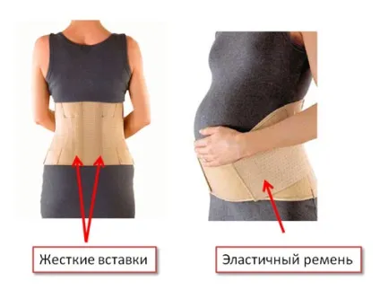 Дородовий бандаж факти, думки, коментарі (бандаж) Дородовий бандаж факти, думки, коментарі