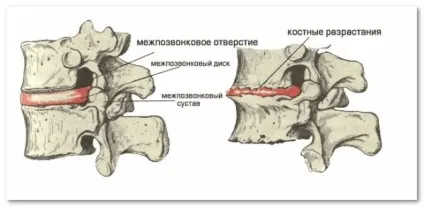 Якщо болять м'язи спини (м'язи) Якщо болять м'язи спини