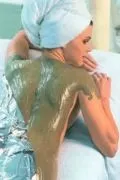 Де можна видалити (прибрати) розтяжки клініки, салони (розтяжки) Де можна видалити (прибрати) розтяжки клініки, салони