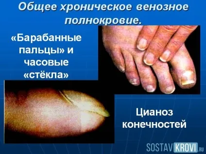 Гіперемія шкіри, обличчя, очей, зіва, у дітей і дорослих, лікування та профілактика