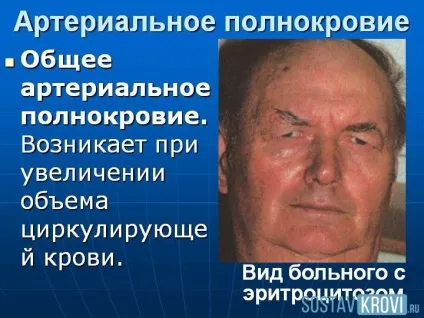 Гіперемія шкіри, обличчя, очей, зіва, у дітей і дорослих, лікування та профілактика