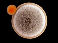 Гриби роду aspergillus опис і клінічне значення (aspergillus) Гриби роду aspergillus опис і клінічне значення