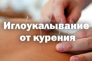 Голковколювання від куріння лікування, чи допомагає, за і проти, гідності, недоліки (куріння) Голковколювання від куріння лікування, чи допомагає, за і проти, гідності, недоліки