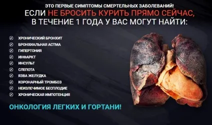 Голковколювання від куріння лікування, чи допомагає, за і проти, гідності, недоліки (проти) Голковколювання від куріння лікування, чи допомагає, за і проти, гідності, недоліки