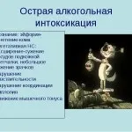 Інтоксикація алкоголем симптоми, медикаментозне лікування (симптоми) Інтоксикація алкоголем симптоми, медикаментозне лікування