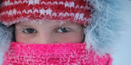 Алергія на холод як проявляється і як виглядає на руках і обличчі, народні засоби від подразнень (ознаки) Алергія на холод як проявляється і як виглядає на руках і обличчі, народні засоби від подразнень