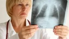 Як відрізнити симптоми вітрянки - чи можна сплутати вітрянку - здоров'я і медицина - популярне (симптоми) Як відрізнити симптоми вітрянки - чи можна сплутати вітрянку - здоров'я і медицина - популярне