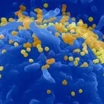 Ангіоліпоми - лікування раку в Ізраїлі, ізраїльський онкологічний центр №1 (ангіоліпоми) Ангіоліпоми - лікування раку в Ізраїлі, ізраїльський онкологічний центр №1