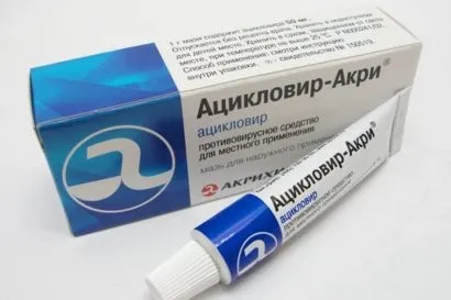 Як зняти свербіж при вітрянці у дорослих і дітей швидко (швидко) Як зняти свербіж при вітрянці у дорослих і дітей швидко