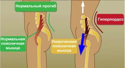 Як сісти на поздовжній шпагат і навіщо це потрібно (шпагат) Як сісти на поздовжній шпагат і навіщо це потрібно