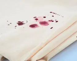 Як вивести пляму від шовковиці (вивести) Як вивести пляму від шовковиці