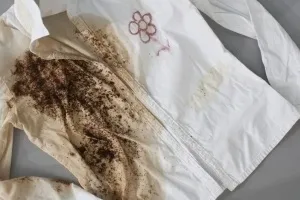 Як вивести цвіль з одягу за допомогою народних засобів (як вивести цвіль) Як вивести цвіль з одягу за допомогою народних засобів