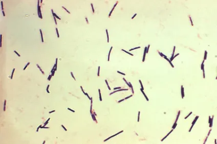 Клостридії перфрингенс (clostridium perfringens)