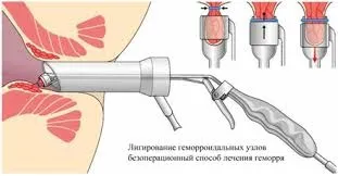Колопроктологічний центр, кгбуз - міська клінічна лікарня №10 - міністерства