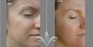 Косметика jeunesse (Женесс) в нашому огляді інтернет-товарів (кілька днів застосування) Косметика jeunesse (Женесс) в нашому огляді інтернет-товарів