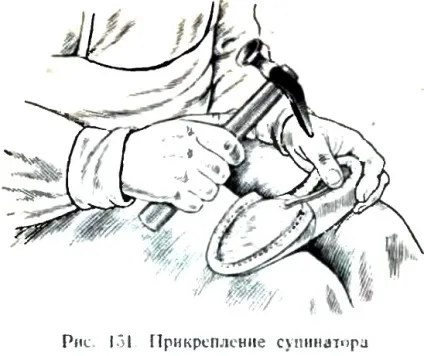 Кріплення Геленка і простілкі