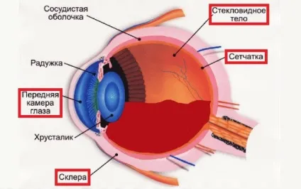 Крововилив в око або криваве око через сітківки або склери (очей) Крововилив в око або криваве око через сітківки або склери