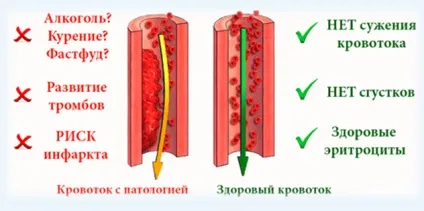 Лікарські трави для розрідження крові кращі рецепти народної медицини від густий крові (рецепти) Лікарські трави для розрідження крові кращі рецепти народної медицини від густий крові