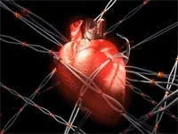 Асистолия серця що це таке, невідкладна допомога, симптоми і лікування (серця) Асистолия серця що це таке, невідкладна допомога, симптоми і лікування