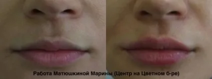 Асиметрія губ на обличчі причини, як виправити (виправити) Асиметрія губ на обличчі причини, як виправити