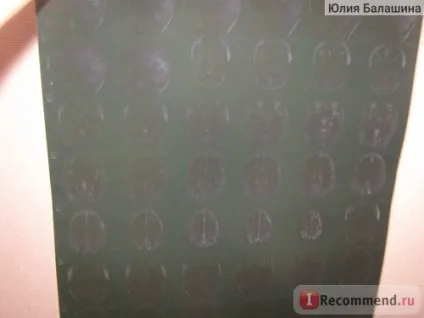 Магнітно-резонансна томографія (МРТ) - «мрт у дітей - чи можна обійтися без наркозу (фото (наркозу) Магнітно-резонансна томографія (МРТ) - «мрт у дітей - чи можна обійтися без наркозу (фото