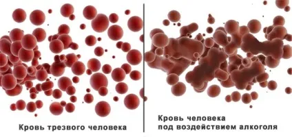 Чи можна пити алкоголь при місячних (червоне вино, пиво) (червоне) Чи можна пити алкоголь при місячних (червоне вино, пиво)