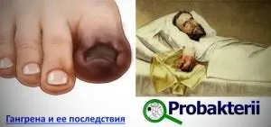 Бактерії - збудники захворювань інфекційних, кишкових, респіраторних (респіраторних) Бактерії - збудники захворювань інфекційних, кишкових, респіраторних