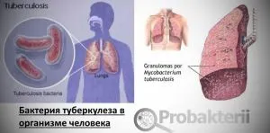 Бактерії - збудники захворювань інфекційних, кишкових, респіраторних (бактерії) Бактерії - збудники захворювань інфекційних, кишкових, респіраторних