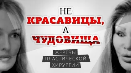 Чи не красуні, а чудовиська жертви пластичної хірургії (форми носа підтяжка) Чи не красуні, а чудовиська жертви пластичної хірургії