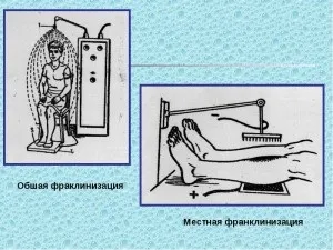 Загальна і місцева франклінізація показання і протипоказання, особливості проведення (показання) Загальна і місцева франклінізація показання і протипоказання, особливості проведення